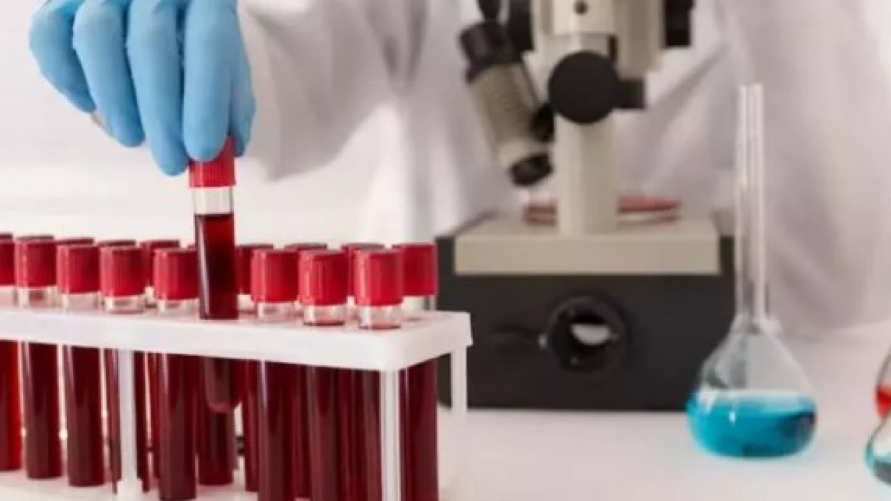 Japon bilim adamları açıkladı: Bu kan gurubuna sahipseniz özelsiniz!