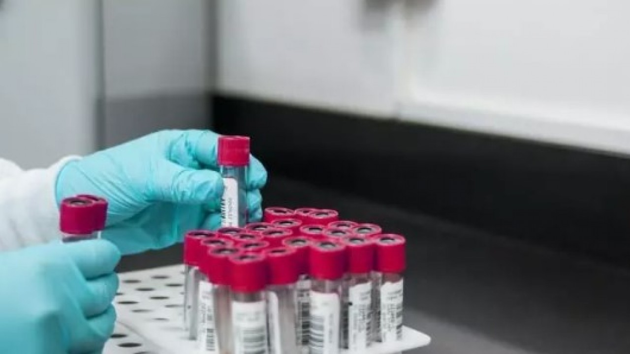 Foto - Japon bilim adamları açıkladı: Bu kan gurubuna sahipseniz özelsiniz!