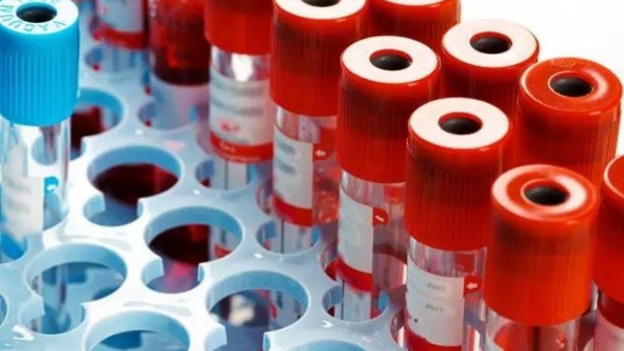 Foto - Japon bilim adamları açıkladı: Bu kan gurubuna sahipseniz özelsiniz!