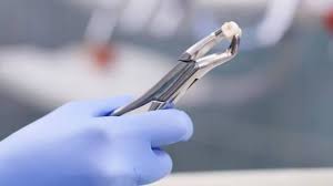 Foto - Japonya'da yeniden diş çıkarma çalışmaları umut vadediyor! Aldıkları yeni kararı: Hala devam sinyali verdi 