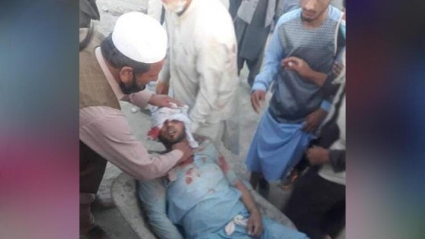 Foto - Kabil'de bilanço ağırlaştı! Ölü sayısını açıkladılar 