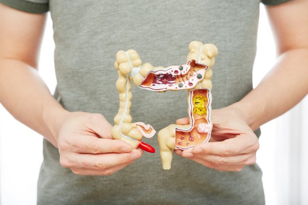 Foto - Kabızlığı daha kötü hale getiren yiyecekler