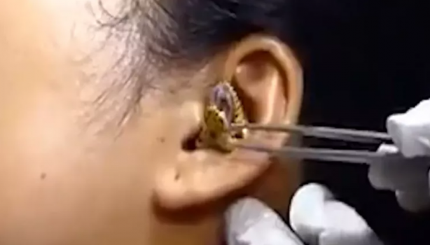 Foto - Kadının kulağına yılan kaçtı! Mide bulandıran görüntü sosyal medyayı ikiye böldü