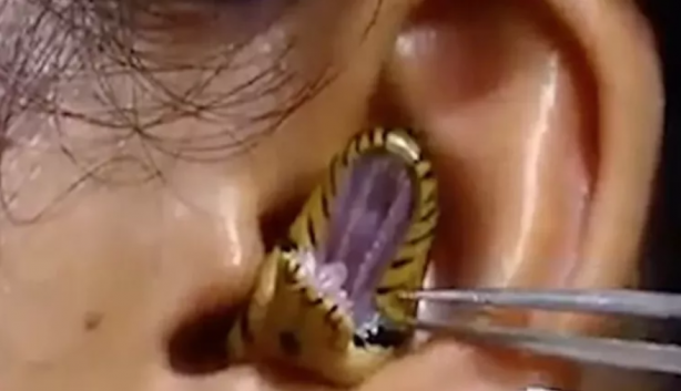 Kadının kulağına yılan kaçtı! Mide bulandıran görüntü sosyal medyayı ikiye böldü