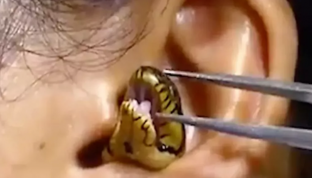 Foto - Kadının kulağına yılan kaçtı! Mide bulandıran görüntü sosyal medyayı ikiye böldü