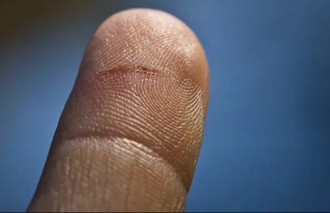 Foto - Kağıt kesiğinin neden canımızı çok yaktığı ortaya çıktı! 