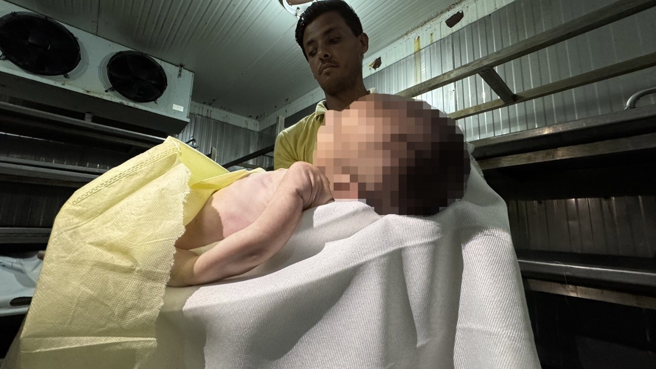 Foto - Kahpe İsrail 2 aylık Muhammed'i aç bırakarak şehit etti