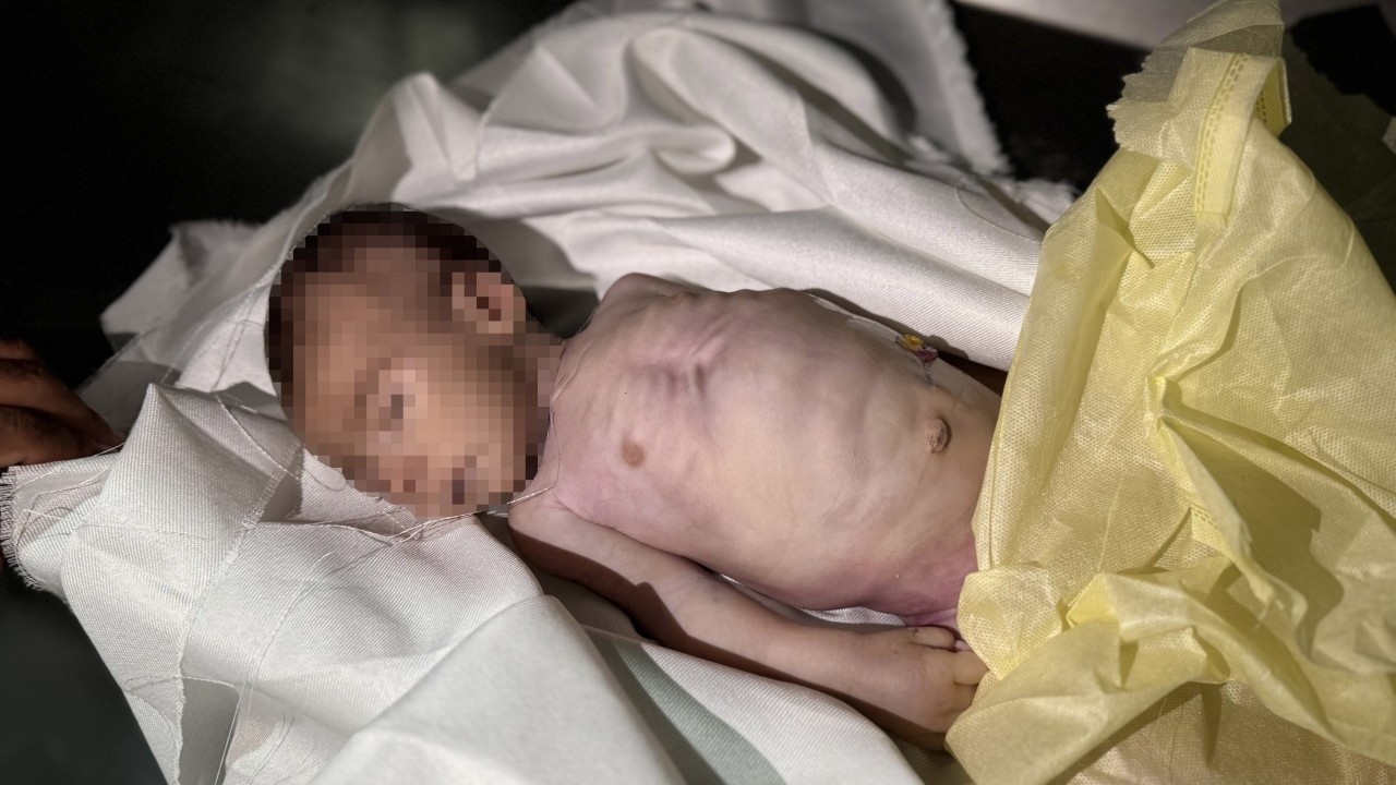 Foto - Kahpe İsrail 2 aylık Muhammed'i aç bırakarak şehit etti