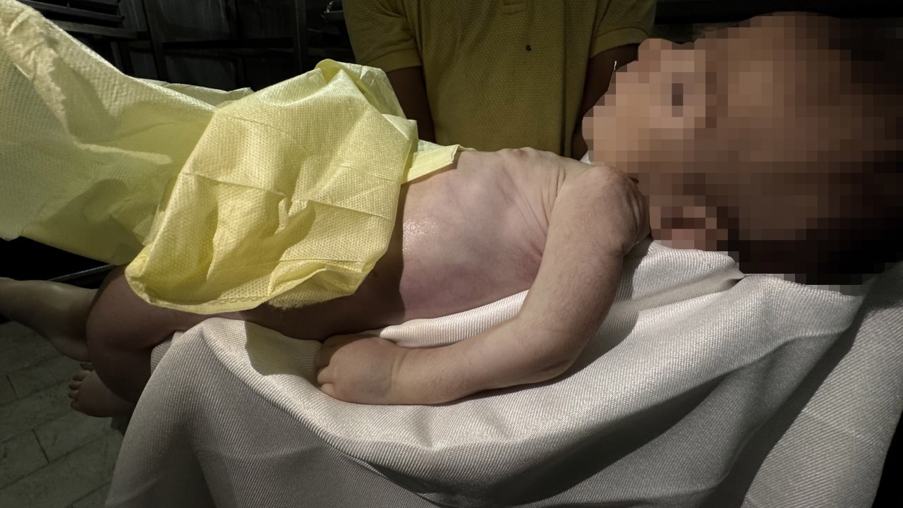 Foto - Kahpe İsrail 2 aylık Muhammed'i aç bırakarak şehit etti