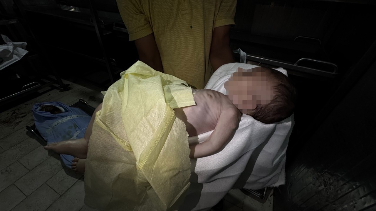 Kahpe İsrail 2 aylık Muhammed'i aç bırakarak şehit etti