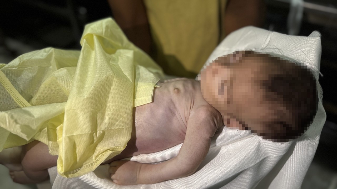 Foto - Kahpe İsrail 2 aylık Muhammed'i aç bırakarak şehit etti