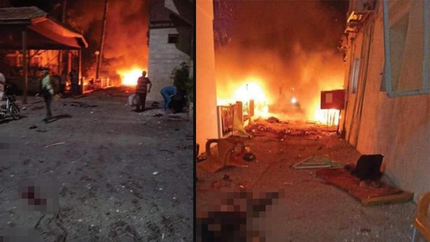 Foto - Kahpe İsrail'in hastane saldırısıyla ilgili şok ayrıntı ortaya çıktı! O detay herkesi şaşkına çevirdi