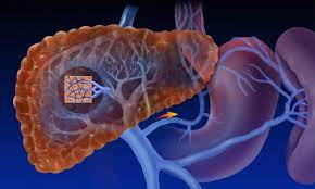 Foto - Kahveyi ıslatıp saçınıza sürerseniz bakın ne oluyor! İlk işimiz değerlendirmek! Suyu böyle: ama bir şartı var