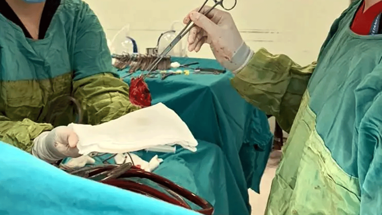 Foto - Doktorlar kalbinden çıkardı! Ağırlığı neredeyse kalp kadar!
