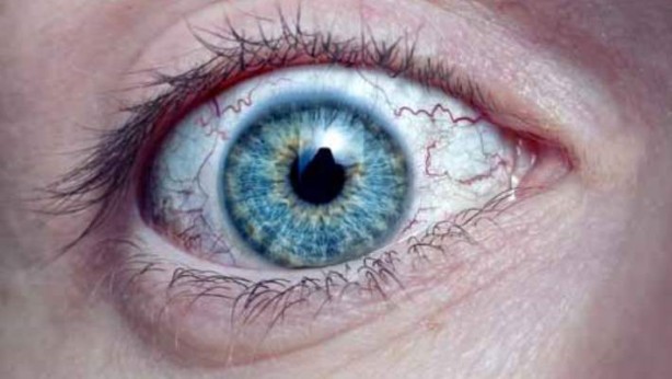 Foto - Kalıcı görme kaybına neden olabilir: Yazın gözlerimizi tehdit eden 8 alışkanlık! Tek tek paylaştı!