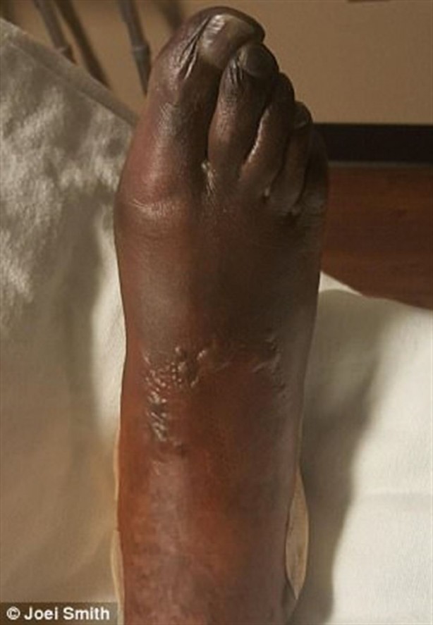 Foto - Kalp çarpıntısı şikayetiyle acile gitti, parmaklarını kestiler!