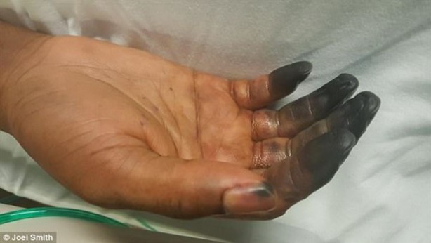 Foto - Kalp çarpıntısı şikayetiyle acile gitti, parmaklarını kestiler!