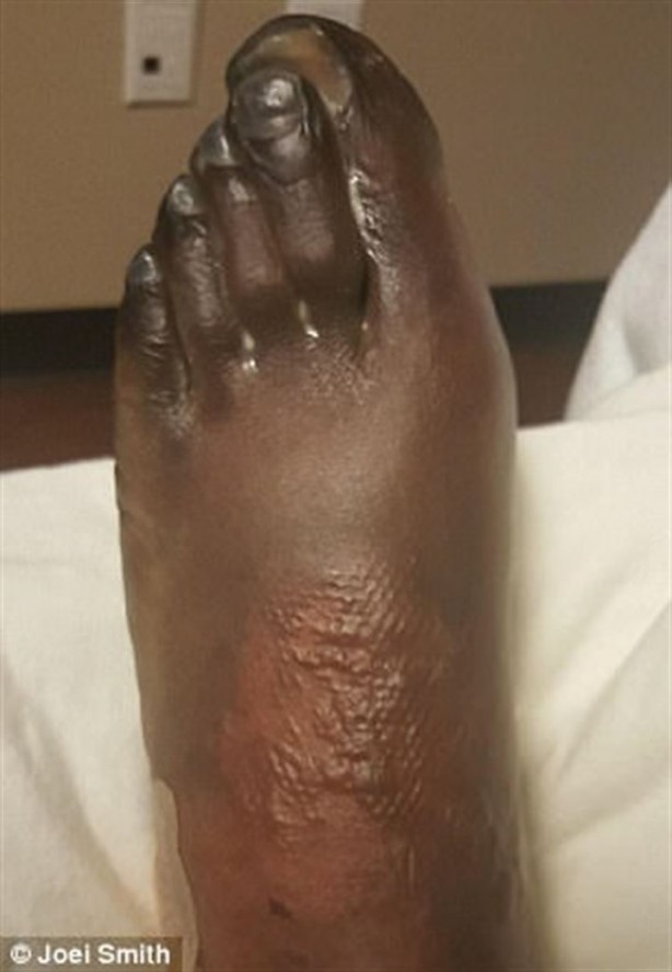 Foto - Kalp çarpıntısı şikayetiyle acile gitti, parmaklarını kestiler!