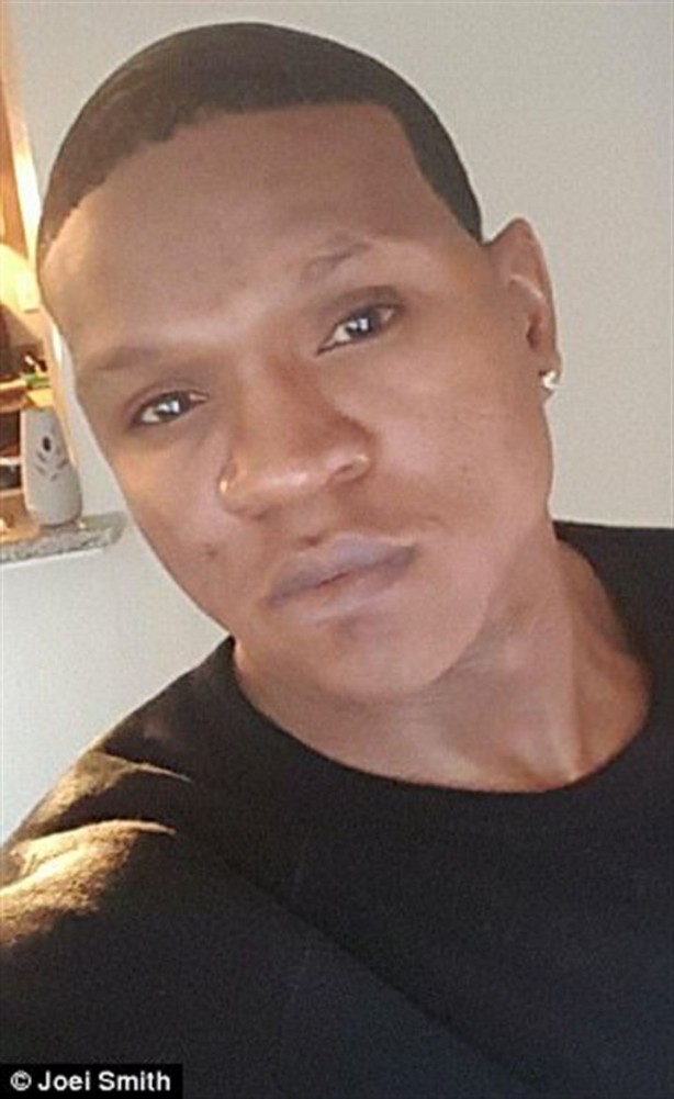 Foto - Kalp çarpıntısı şikayetiyle acile gitti, parmaklarını kestiler!