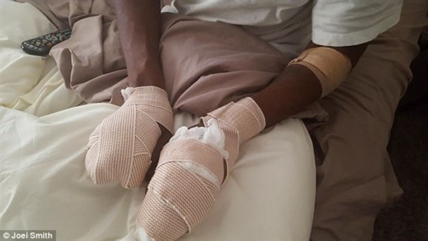 Foto - Kalp çarpıntısı şikayetiyle acile gitti, parmaklarını kestiler!