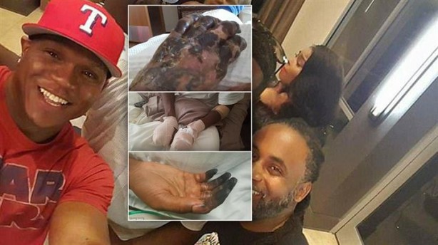 Kalp çarpıntısı şikayetiyle acile gitti, parmaklarını kestiler!