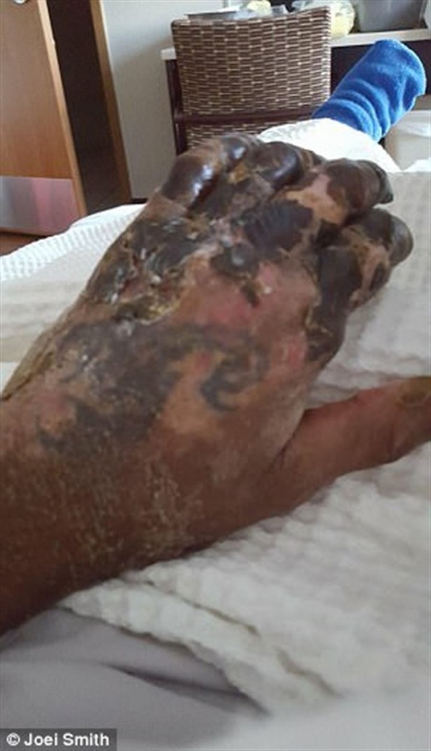 Foto - Kalp çarpıntısı şikayetiyle acile gitti, parmaklarını kestiler!