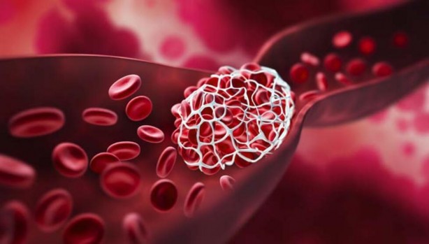 Foto - Kalp hastalıklarına karşı 10 doğal kan sulandırıcı