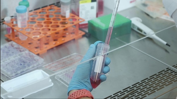 Foto - Kalp sağlığı için çok konuşulacak çalışma