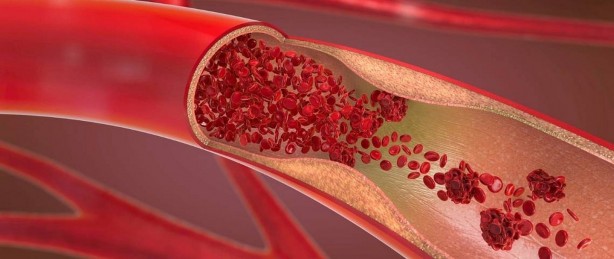 Foto - Kan dolaşımına iyi gelen 5 bitki