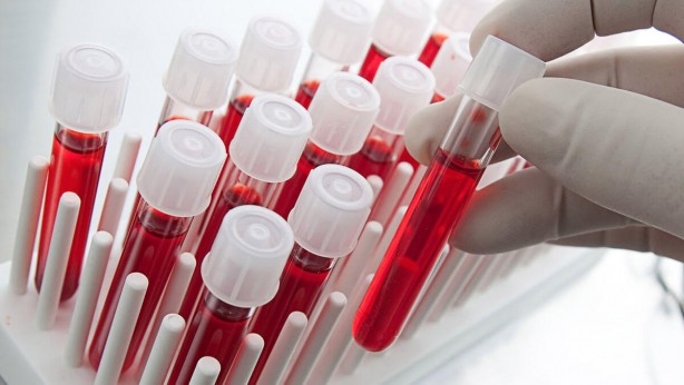 Foto - Kan grubuna göre beslenmenizde dikkat etmeniz gereken noktalar