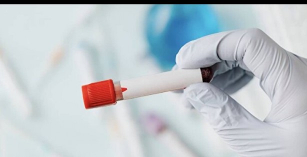 Foto - Kan grubunuz kişiliğinizi ele veriyor! İşte dikkat çeken özellikler