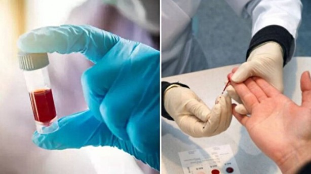 Foto - Kan grubunuz kişiliğinizi ele veriyor! İşte dikkat çeken özellikler