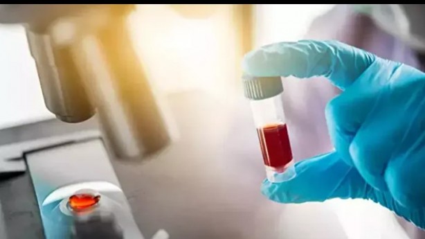 Foto - Kan grubunuz kişiliğinizi ele veriyor! İşte dikkat çeken özellikler