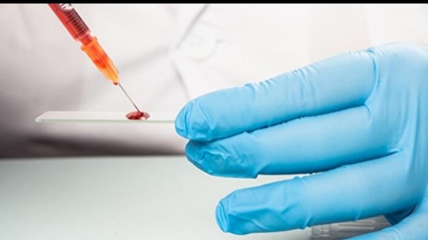 Foto - Kan grubunuz kişiliğinizi ele veriyor! İşte dikkat çeken özellikler