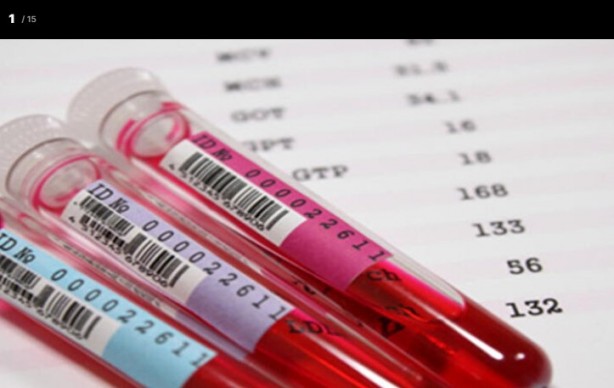 Foto - Kan grubunuz kişiliğinizi ele veriyor! İşte dikkat çeken özellikler