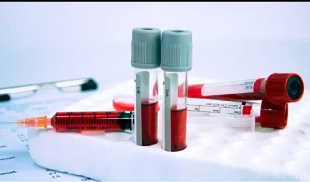 Foto - Kan grubunuz kişiliğinizi ele veriyor! İşte dikkat çeken özellikler