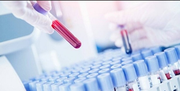 Kan grubunuz kişiliğinizi ele veriyor! İşte dikkat çeken özellikler