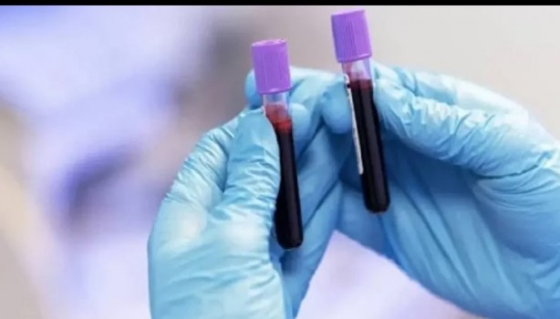 Foto - Kan grubunuz kişiliğinizi ele veriyor! İşte dikkat çeken özellikler