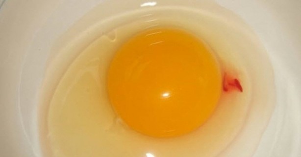 Kan pıhtısı olan yumurtayı yemek zararlı mı?