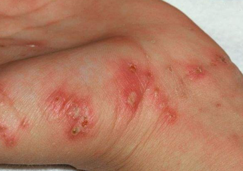 Foto - Kan şekerini dengelemenin tek çözümü! Sporcular antrenman sonrası ilk ona sarılıyor… Geri kalan her şeyi unutun