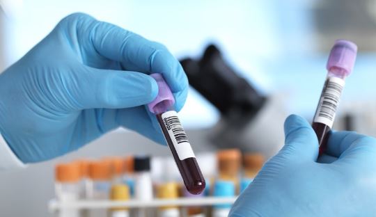 Foto - Kan testiyle kanseri tespit ettiler