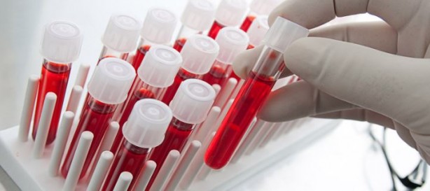 Foto - Kan testiyle kanseri tespit ettiler