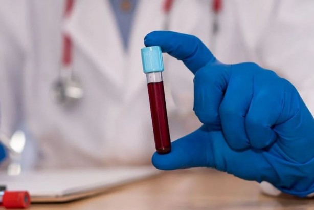 Foto - Kan testiyle kanseri tespit ettiler