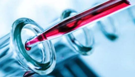 Foto - Kan testiyle kanseri tespit ettiler