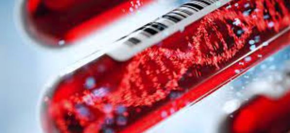 Kan testiyle kanseri tespit ettiler