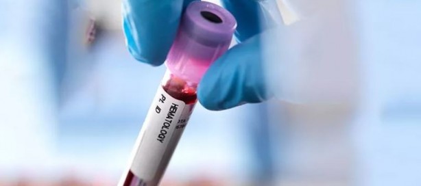 Foto - Kan testiyle kanseri tespit ettiler