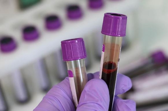 Foto - Kan testiyle kanseri tespit ettiler