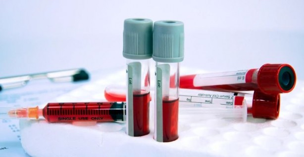 Foto - Kan testiyle kanseri tespit ettiler