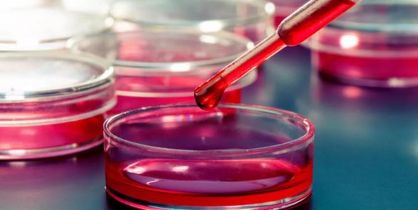 Foto - Kan testiyle kanseri tespit ettiler