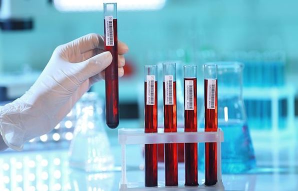 Foto - Kan testiyle kanseri tespit ettiler